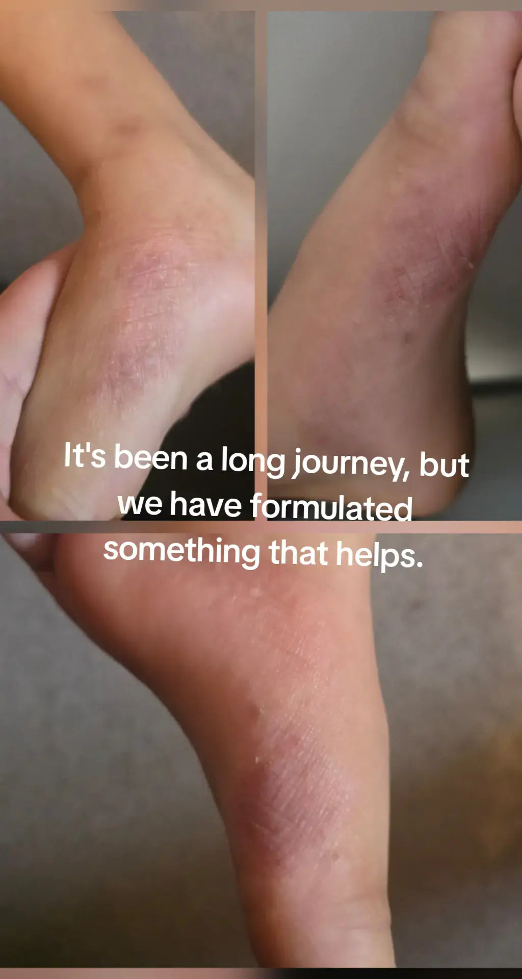 Gentle Baby Balm – Tallow, Shea, Cocoa Butter & Chamomile Hydrosol