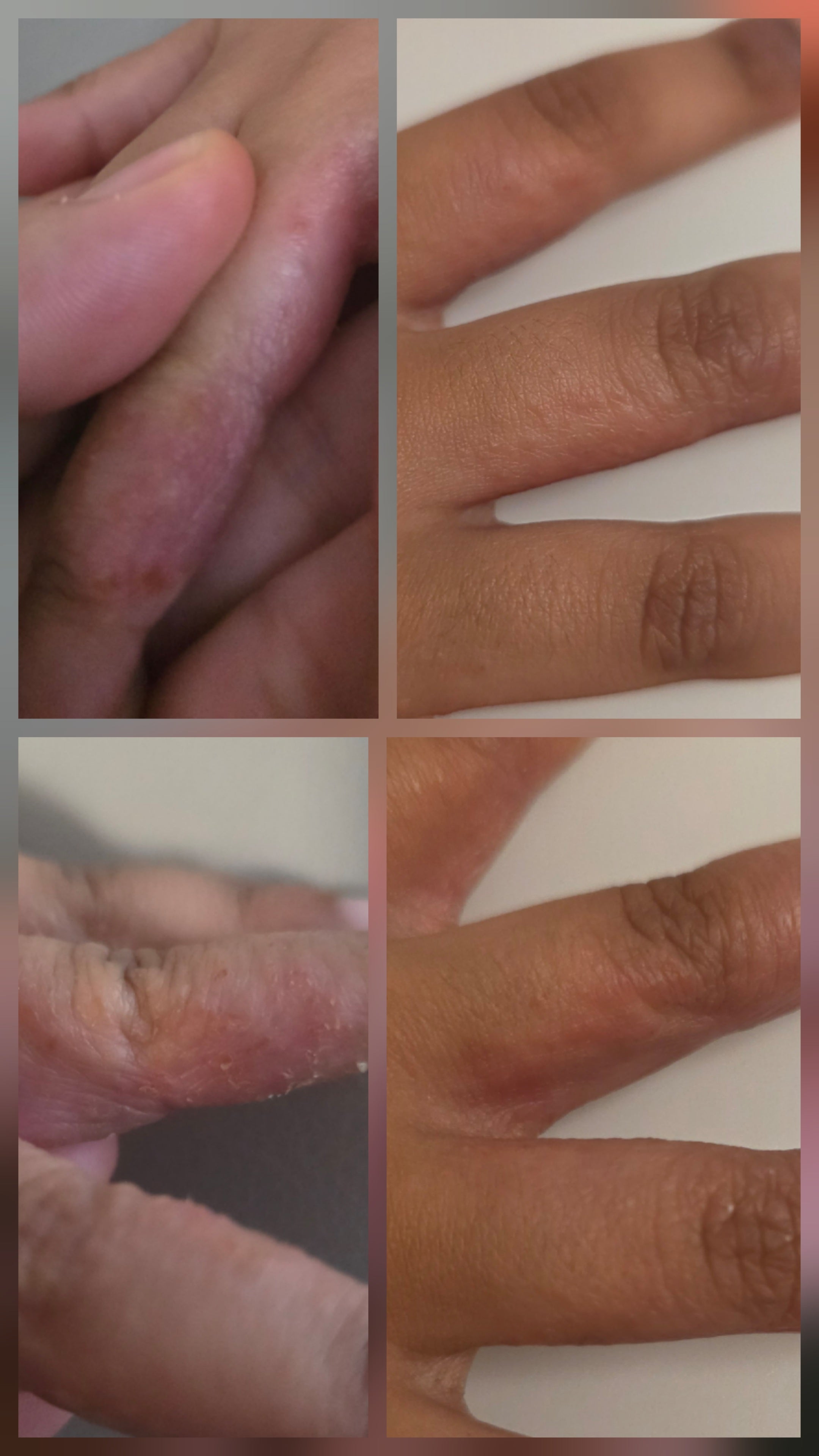 Gentle Baby Balm – Tallow, Shea, Cocoa Butter & Chamomile Hydrosol