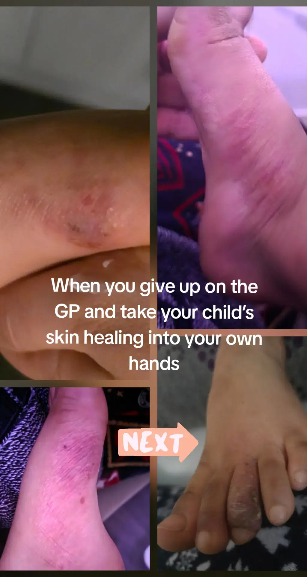 Gentle Baby Balm – Tallow, Shea, Cocoa Butter & Chamomile Hydrosol